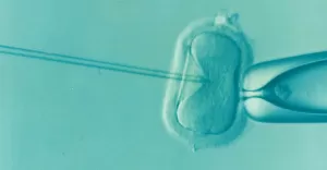 Procedura in vitro