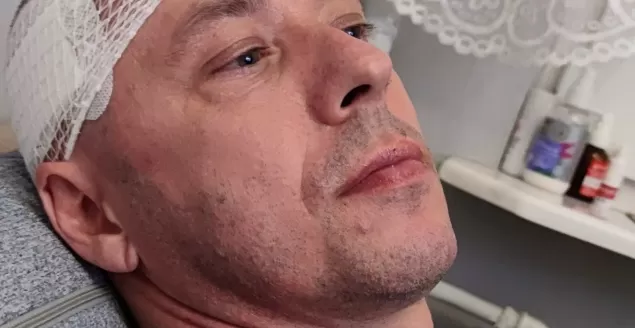 Pan Piotr ma glejaka. Pilnie potrzebuje naszej pomocy