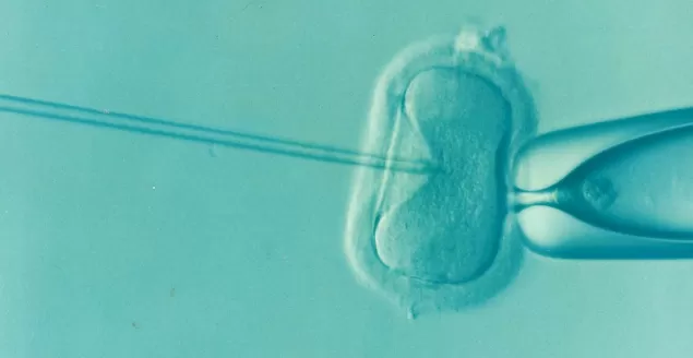 Procedura in vitro