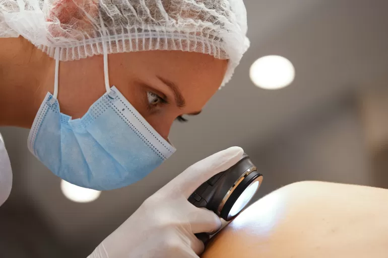 Badanie dermatoskopowe w klinice U Lekarzy w Warszawie