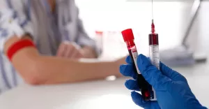 probatezyczkowajakprzeprowadzasiebadanieidlaczegojestistotnedlaochronyzdrowia